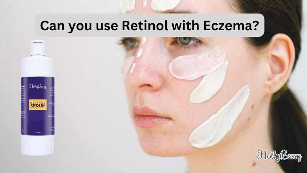 Can you use Retinol with Eczema? Hollyberry Cosmetics UK