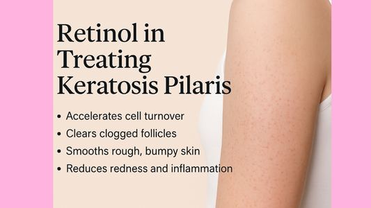 Retinol in Treating Keratosis Pilaris
