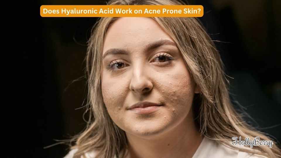 Does Hyaluronic Acid Really Work on Acne Prone Skin