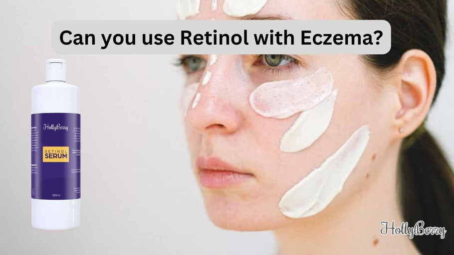 Can you use Retinol with Eczema?