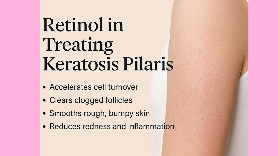 Retinol in Treating Keratosis Pilaris