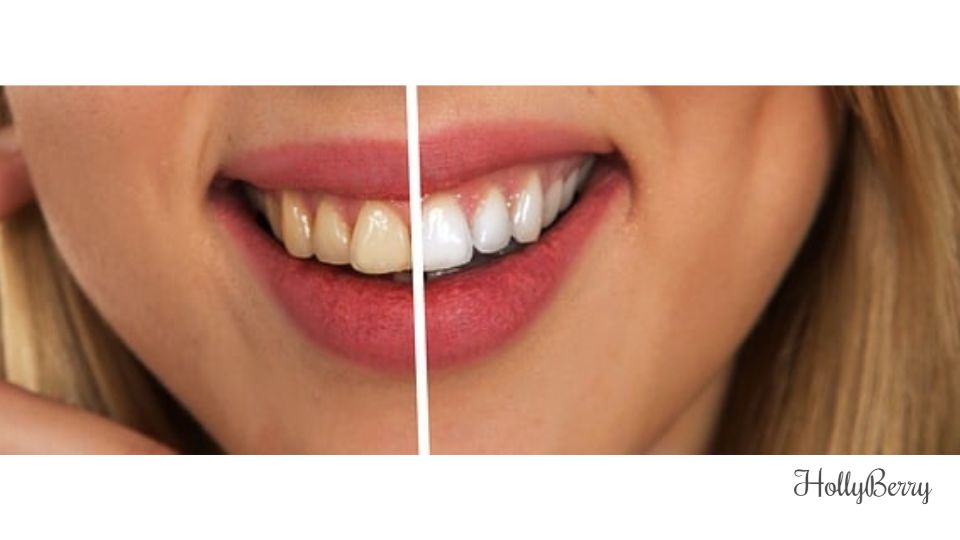 How to whiten your teeth with household products Hollyberry Cosmetics UK