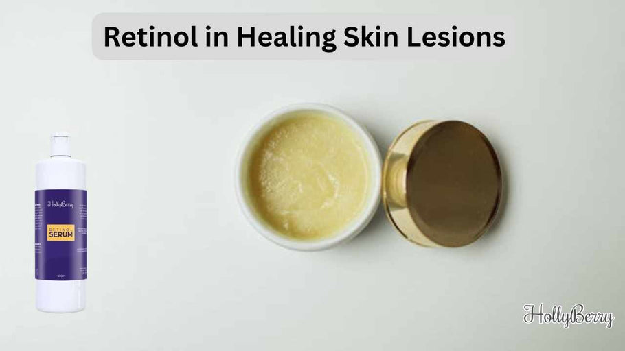 Retinol in Healing Skin Lesions