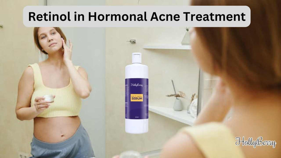 Retinol in Hormonal Acne Treatment